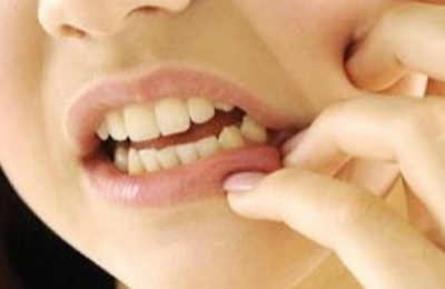 突發(fā)性、自發(fā)性的劇烈牙疼