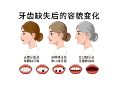 【科學(xué)科普】十個(gè)常用的口腔小知識(shí)！