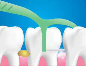 口腔問題可能要“命”！5大預警信號，別忽視