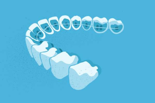 惟德口腔醫(yī)院口腔正畸好不好？